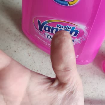 Vanish Kosla Oxi Action Sıvı Leke Çıkarıcı Ellerde Yanma Ve Acı Hissi Oluşturdu
