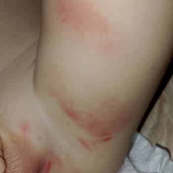 Molfix Bebek Bezi Pişik Yaptı Müşteri Hizmetlerinden Dönüş Alamadım