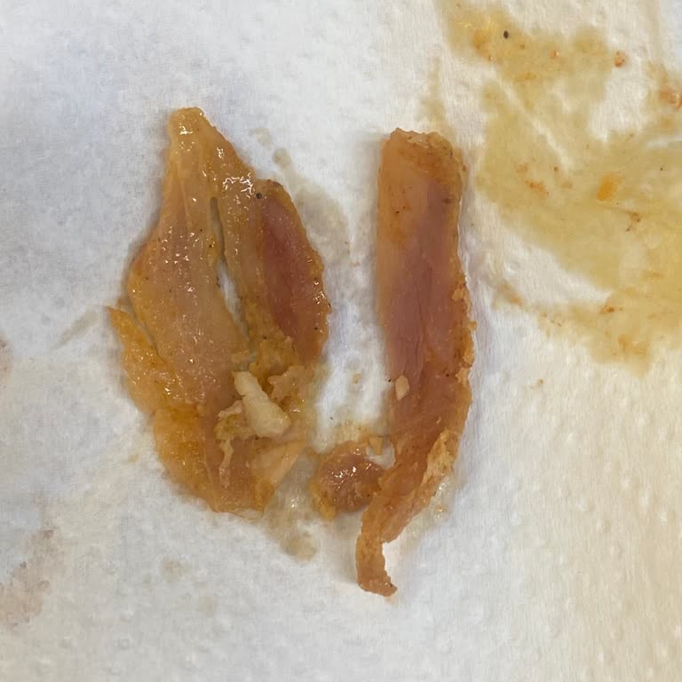 Maydanoz Döner Polatlı Şubesinde Tekrarlanan Çiğ Tavuk Döner Ve Sağlık Sorunları