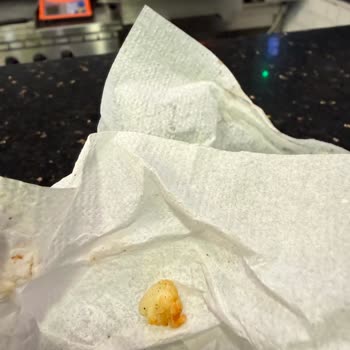 Ekrem Coşkun Döner'de Kıkırdaklı Tavuk Ve İlgisiz Personel Nedeniyle Mağduriyet