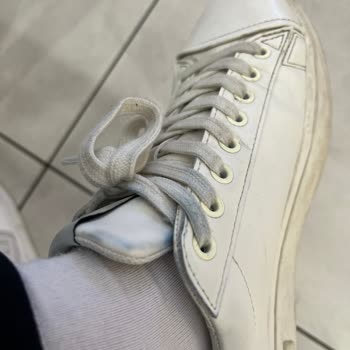 Levis Pantolonlarımın Renk Atması Ve Mağaza İlgisizliği Mağduriyet Yaratıyor