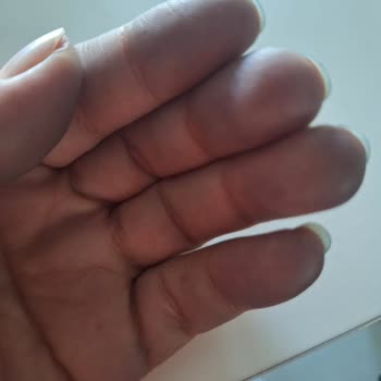 Levis Pantolonlarımın Renk Atması Ve Mağaza İlgisizliği Mağduriyet Yaratıyor