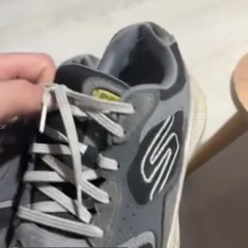 Skechers Ayakkabıda Kısa Sürede Oluşan Deformasyon Ve Çözümsüzlük!