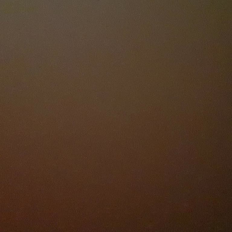 Kredi Kartı Taksitlerinde Eksik Görünen Tutar Ve Yanıtsız Destek Talebi