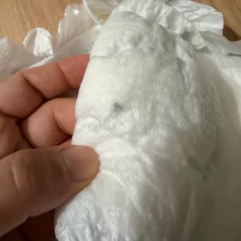 Bebek Bezinde Yabancı Cisim Şoku: Güvenlik Ve Hijyen Endişesi