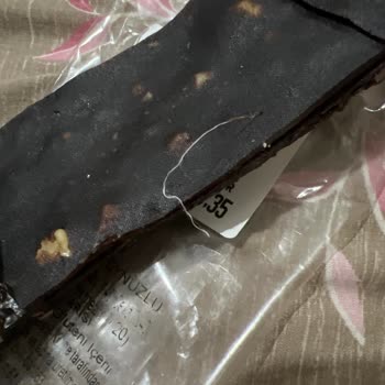 Cevizli Pestilde Hijyen Sorunu: Yabancı Cisim Şoku!