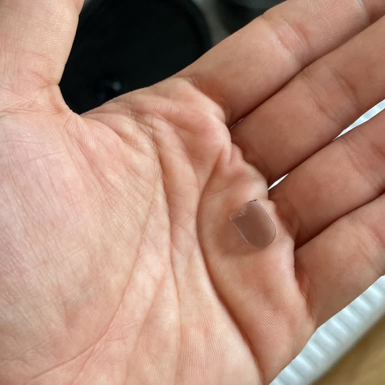 Kochler Mama Kabının Garanti Kapsamında Değiştirilmemesi