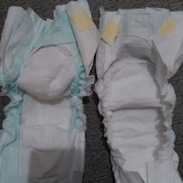 Prima Premium Care Bebek Bezinde Kalite Farklılığı Ve Cilt Sorunları