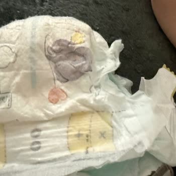 Prima Premium Care 5 Numara Bez Bebeğimin Cildini Kesti Ve Kanattı, Güvenimiz Sarsıldı