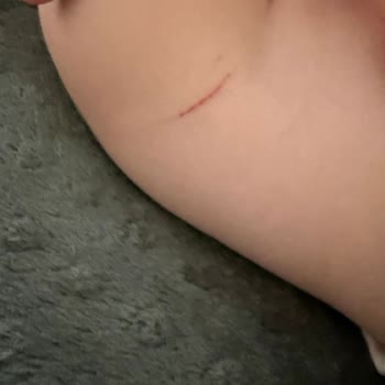 Prima Premium Care 5 Numara Bez Bebeğimin Cildini Kesti Ve Kanattı, Güvenimiz Sarsıldı