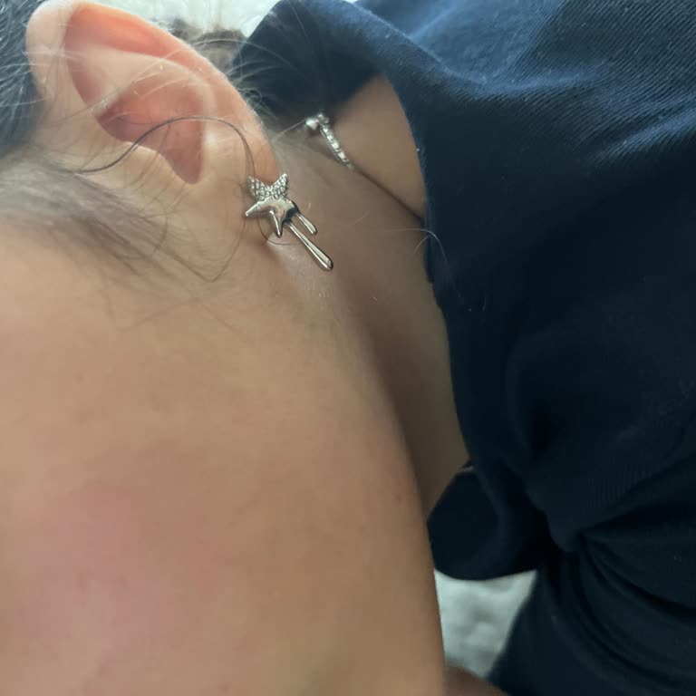 Yves Rocher Yüz Yıkama Jeli Ailecek Ciltte Kızarıklık Ve Yanma Yaptı, Açıklama Bekliyorum