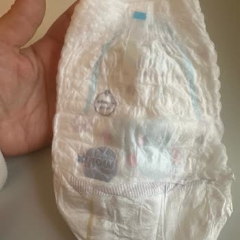 Molfix 6 Numara Külot Bezde Ters Basım Hatası Nedeniyle Kullanım Zorluğu Yaşadım