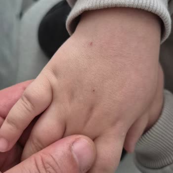 Özel Gözde Hastaneleri Acil Serviste Yetersiz Hemşirelik Müdahalesi Ve İlgisizlik!