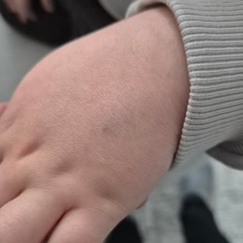 Özel Gözde Hastaneleri Acil Serviste Yetersiz Hemşirelik Müdahalesi Ve İlgisizlik!