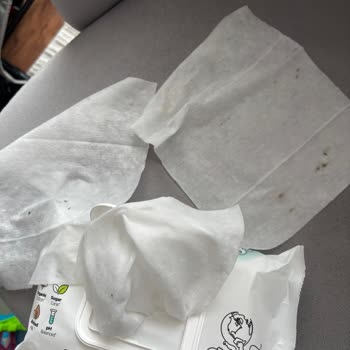 Islak Mendillerdeki Lekeler Hijyen Endişesi Ve Çözüm Talebi