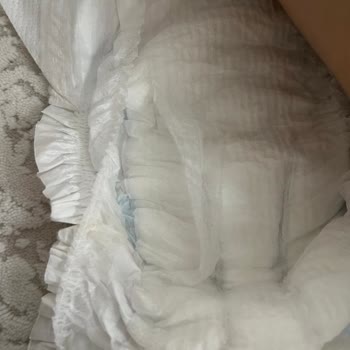 Molfix 5 Numara Bebek Bezinde Ciddi Üretim Hatası Ve Sağlık Riski