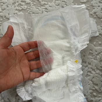 Molfix 5 Numara Bebek Bezinde Ciddi Üretim Hatası Ve Sağlık Riski