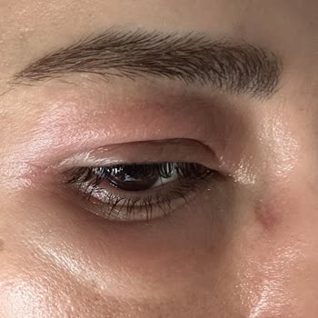 Vionine Firmanın Ve Çalışanlarının İnsan Sağlığına Önem Vermemesi