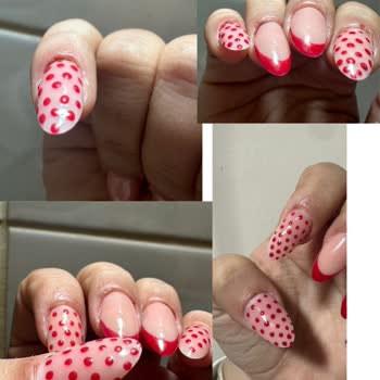 Protez Tırnak İşlemi Sonrası Sağlık Sorunları Ve Saygısız Tutum Mağduriyeti