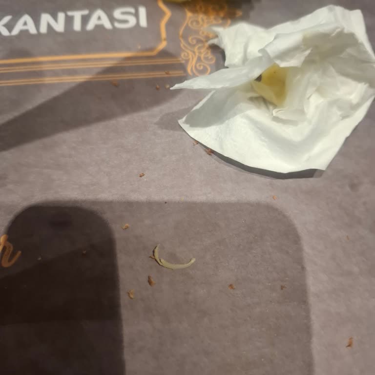 Yemeğimde Tırnak Çıkması Nedeniyle Güven Sorunu Yaşıyorum