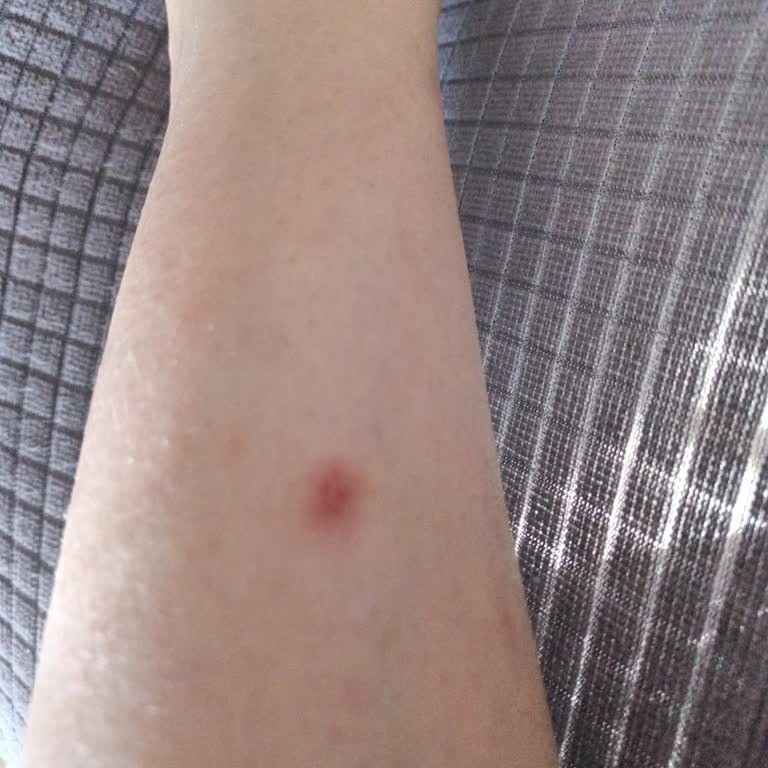 Aldığım Bot Sağlığımı Tehdit Etti, İade Talep Ediyorum