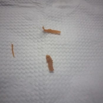 Lezzet Hane Mantıdan Yabancı Madde Çıkması Hayal Kırıklığı Yarattı