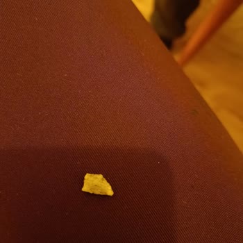 Master Potato Üründen Çıkan Sert Parça Dişimi Kırdı, Çocuklar İçin Büyük Tehlike