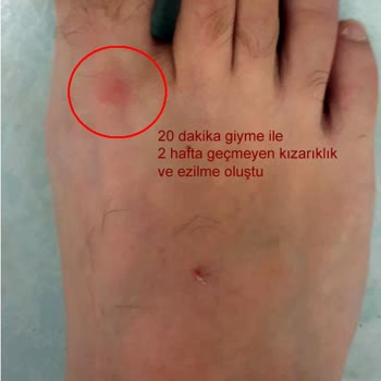 Adidas Ayakkabıda Kalıp Hatası Ve Yetersiz İnceleme Sonucu