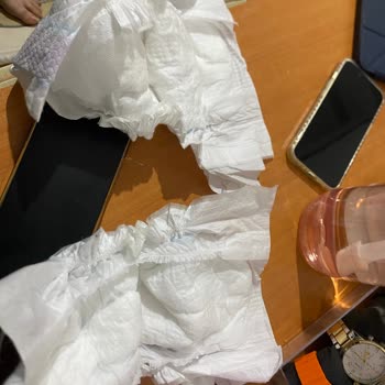 Molfix Bebek Bezinde Üretim Hatası: Eksik Bel Bandı