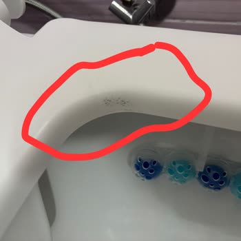 Klozet Kapağı Arızası Ve Yetersiz Teknik Servis Mağduriyeti