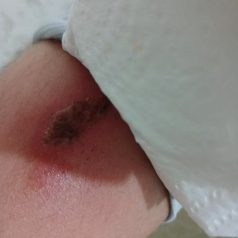 Beraat Almama Rağmen Çocuğumun Bana Teslim Edilmemesi Ve Yaşadığı Kötü Koşullar