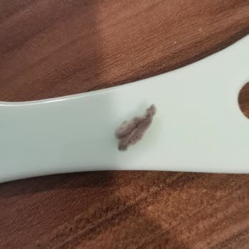 Bebek Bezinde Belirsiz Lekeler Güvenimizi Sarsıyor