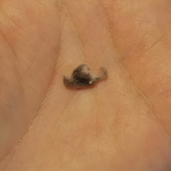 Bebek Bezinde Belirsiz Lekeler Güvenimizi Sarsıyor