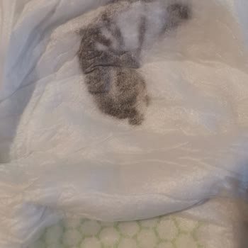 Bebek Bezinde Belirsiz Lekeler Güvenimizi Sarsıyor