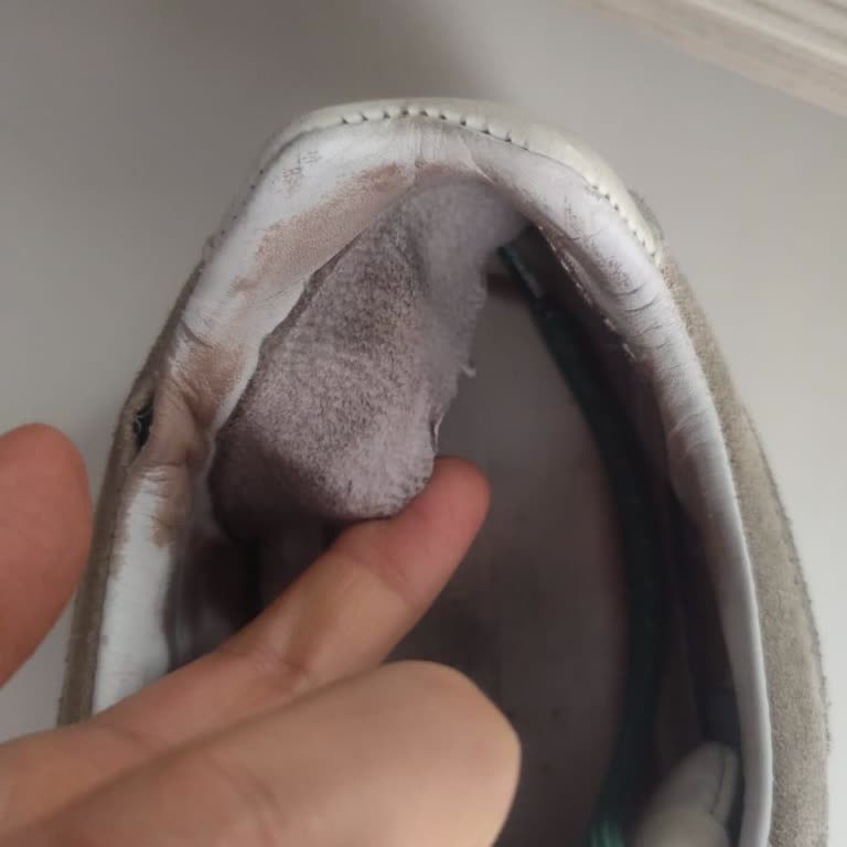 Kısa Sürede Deforme Olan Ayakkabı Ve Olumsuz Müşteri Hizmeti Deneyimi