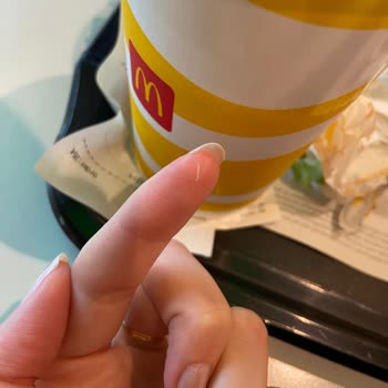 Siparişimde Tavuk Tüyü Çıktı, Hijyen Ve Güvenlik Endişesi Yaşıyorum