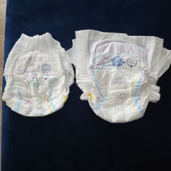 Molfix Bezin Dar Kalıbı Ve Müşteri Hizmetlerinde Yaşanan İlgisizlik Hayal Kırıklığı