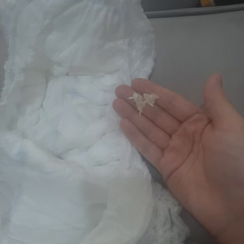 Molfix 7 Numara Külot Bezde Sert Parçalar Nedeniyle Bebeğimin Canı Yandı, Geri Dönüş Alamadım