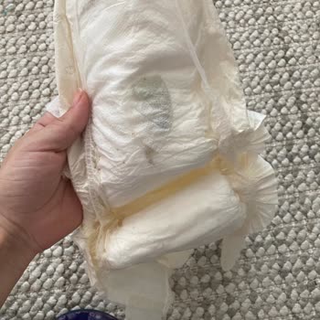 Bebek Bezinde Yabancı Madde: Hijyen Ve Güvenlik Endişesi