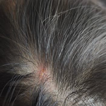 Bebeklere Uygun Sprey Ciddi Sağlık Sorunlarına Yol Açtı