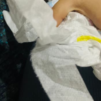 Molfix Bebek Bezinde Yan Bant Sorunu Ve Kalite Kontrol Endişesi