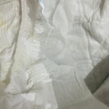 Molfix Bebek Bezinde Yan Bant Sorunu Ve Kalite Kontrol Endişesi