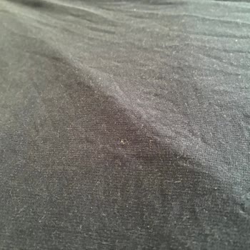 Profilo Çamaşır Makinesi Sürekli Tüylenme Ve Temizlememe Sorunu, Servisten Çözüm Alınamıyor