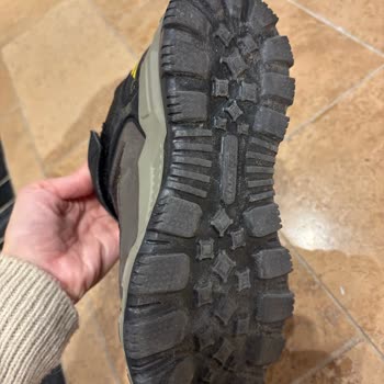 Skechers Kids Ayakkabı Çocuğumda Şiddetli Ayak Şişmesi Ve Kaşıntıya Sebep Oldu