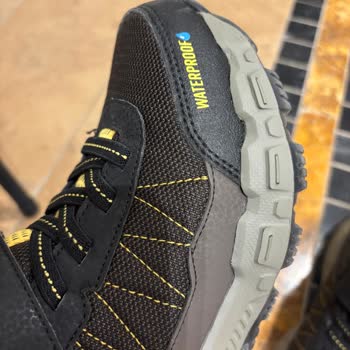 Skechers Kids Ayakkabı Çocuğumda Şiddetli Ayak Şişmesi Ve Kaşıntıya Sebep Oldu