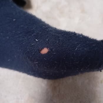 İlk Kullanımda Yırtılan Çorap Hayal Kırıklığı