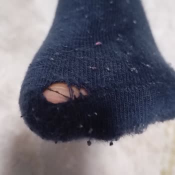 İlk Kullanımda Yırtılan Çorap Hayal Kırıklığı