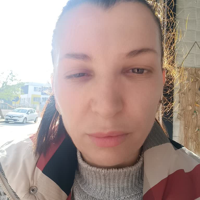 Botoks Sonrası Yüzümde Oluşan Şekil Bozukluğu Ve Mağduriyetim