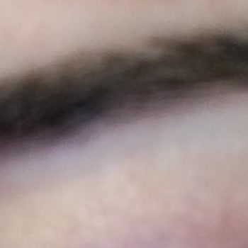 Microblading İşleminde Şekil Bozukluğu Ve Ücret İadesi Sorunu