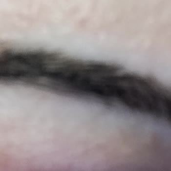 Microblading İşleminde Şekil Bozukluğu Ve Ücret İadesi Sorunu